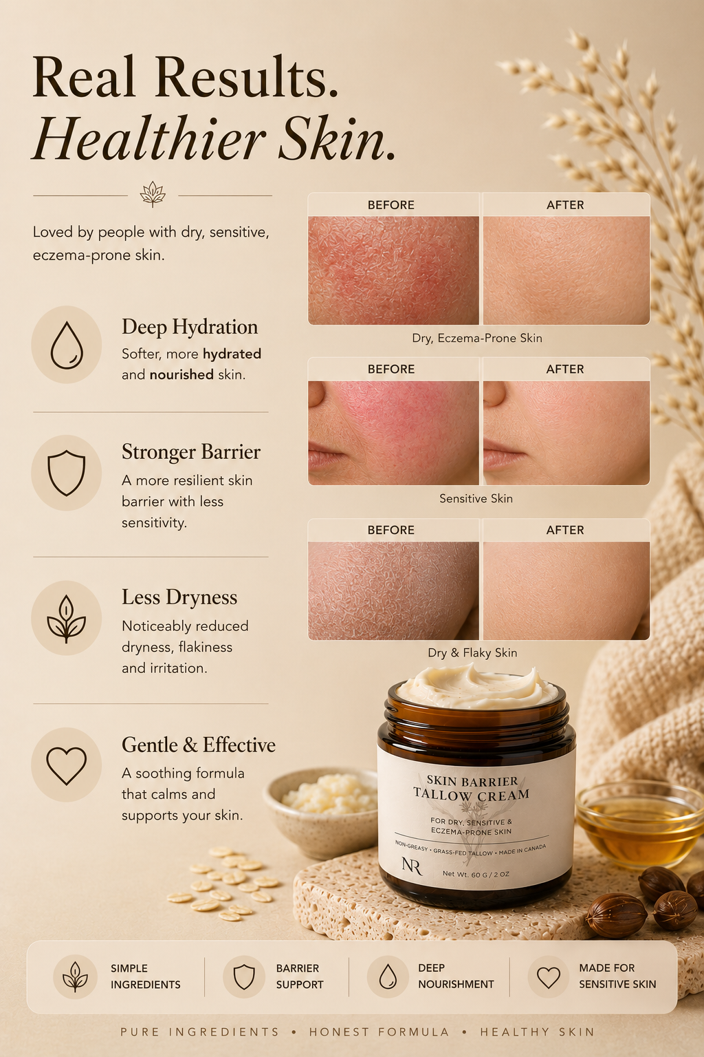 Skin Barrier Tallow Cream - For Dry, Eczema-Prone Skin