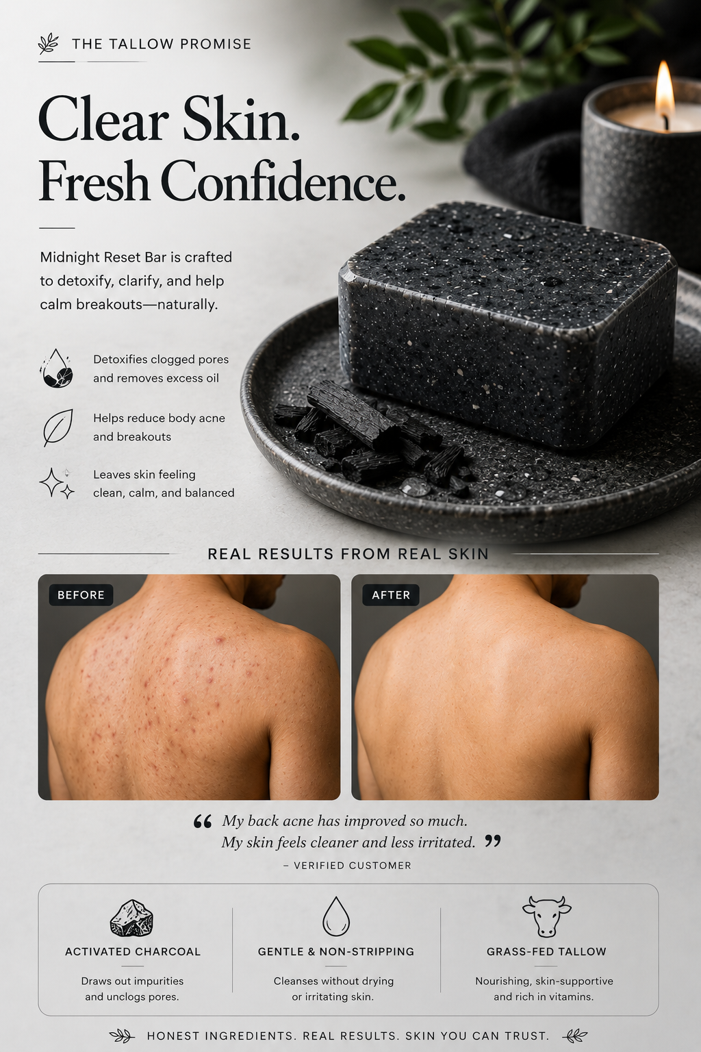 Midnight Reset – Deep Cleansing Acne Bar for Congested, Breakout-Prone Skin